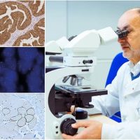 Leica Biosystems Panel de Anticuerpos para Mama