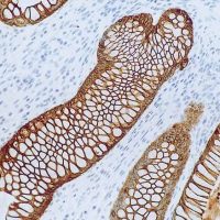 Leica Biosystems Panel de Anticuerpos para Diferenciación Tumoral